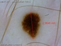 AM4113ZT Dino-Lite 1.3MP (With Polarizer) USB Digital Microscope -Wildlife Monitoring Equipment 190263 2